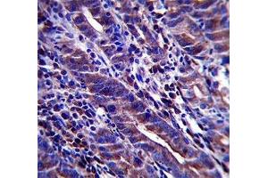 MUC-1 antibody immunohistochemistry analysis in formalin fixed and paraffin embedded human stomach tissue. (MUC1 antibody  (AA 1176-1205))