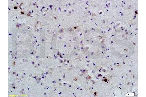 Formalin-fixed and paraffin-embedded rat brain labeled with Anti-BNP Polyclonal Antibody, Unconjugated (ABIN678623) 1:200, overnight at 4 °C, The secondary antibody was Goat Anti-Rabbit IgG, Cy3 conjugated used at 1:200 dilution for 40 minutes at 37 °C.