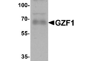 Western blot analysis of GZF1 in human heart tissue lysate with GZF1 antibody at 1 µg/mL. (ZNF336 antibody  (C-Term))