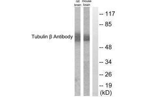 Western blot analysis of extracts from rat cells and mouse brain cells, using Tubulin β antibody. (TUBB3 antibody  (C-Term))