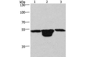 Western Blot analysis of Hela cell, Mouse muscle and kidney tissue using PLEKHO1 Polyclonal Antibody at dilution of 1:200 (PLEKHO1 antibody)