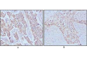 Immunohistochemical analysis of paraffin-embedded human breast cancer,Lung breast tissues using EGF mouse mAb (EGF antibody)
