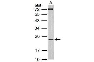 WB Image Sample (30 ug of whole cell lysate) A: 293T 12% SDS PAGE antibody diluted at 1:500 (AICDA antibody  (N-Term))