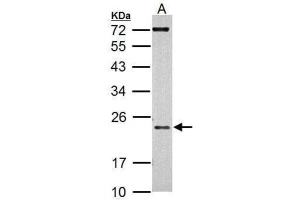 AICDA antibody  (N-Term)