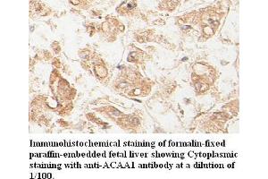 Image no. 1 for anti-Acetyl-CoA Acyltransferase 1 (ACAA1) antibody (ABIN791175) (ACAA1 antibody)