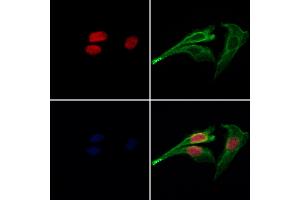 ABIN7094124 and ABIN7098168 staining Hela cells by IF/ICC.