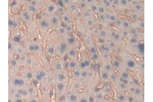 Immunohistochemistry (IHC) image for anti-Fibrinogen beta Chain (FGB) (AA 35-481) antibody (ABIN7433273)