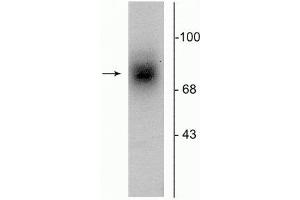 Western blot of human striatal lysate showing specific immunolabeling of the ~88 kDa DAT protein. (SLC6A3 antibody  (Extracellular Loop))