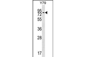K Antibody  (ABIN391782 and ABIN2841639) western blot analysis in Y79 cell line lysates (35 μg/lane). (MAK antibody  (C-Term))