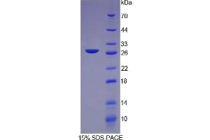 SDS-PAGE (SDS) image for C-Reactive Protein (CRP) ELISA Kit (ABIN6574109)