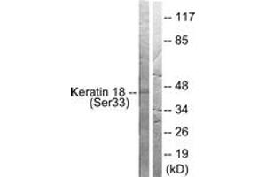 Western blot analysis of extracts from HT29 cells, using Keratin 18 (Phospho-Ser33) Antibody. (Cytokeratin 18 antibody  (pSer34))