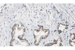 ABIN6275433 at 1/100 staining Human prostate tissue by IHC-P. (CHML antibody  (Internal Region))