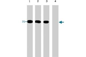 Western blots of human PAK6 recombinant protein phosphorylated by ERK2.