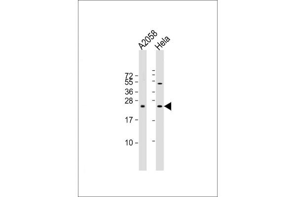 SDHD antibody  (N-Term)