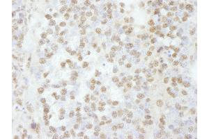 Immunohistochemistry (IHC) image for anti-RNA Binding Motif Protein 16 (RBM16) (C-Term) antibody (ABIN7448761) (RBM16 antibody  (C-Term))