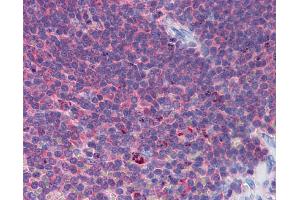 IHC Information: Paraffin embedded spleen tissue, tested with an antibody dilution of 5 ug/ml. (IFIH1 antibody  (Middle Region))