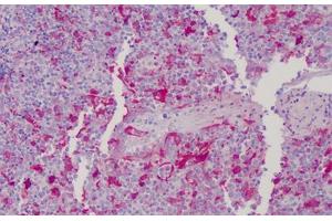 Human Tonsil: Formalin-Fixed, Paraffin-Embedded (FFPE) (Gelsolin antibody  (AA 161-369))