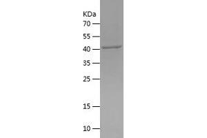 MBIP Protein (AA 1-344) (His tag)