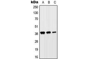 Western blot analysis of SLC10A7 expression in HeLa (A), HepG2 (B), H9C2 (C) whole cell lysates. (SLC10A7 antibody  (Center))