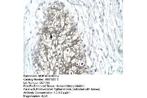 Human urinary bladder (MMP19 antibody  (C-Term))