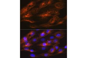 Immunofluorescence analysis of C6 cells using βII-Tubulin/β2-Tubulin Rabbit mAb (ABIN1680983, ABIN3019216, ABIN3019217 and ABIN7101733) at dilution of 1:100 (40x lens). (TUBB2A/TUBB2B antibody)