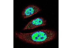 Immunofluorescence (IF) image for anti-tyrosyl-DNA phosphodiesterase 2 (TDP2) antibody (ABIN2996093) (TDP2 antibody)