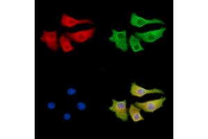 ABIN7095493 and ABIN7099550 staining Hela cells by IF/ICC. (Phosphoglucomutase 3 antibody)