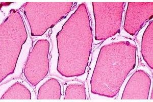 Human Skeletal Muscle: Formalin-Fixed, Paraffin-Embedded (FFPE) (Myoglobin antibody)