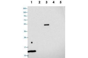 Western blot analysis of Lane 1: RT-4, Lane 2: U-251 MG, Lane 3: Human Plasma, Lane 4: Liver, Lane 5: Tonsil with MRPL35 polyclonal antibody . (MRPL35 antibody)
