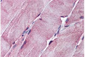 Human Skeletal Muscle: Formalin-Fixed, Paraffin-Embedded (FFPE) (SGCE antibody  (AA 36-85))