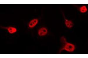 ABIN6274587 staining 293 by IF/ICC. (Apoptosis Inhibitor 5 antibody  (C-Term))
