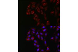 Immunofluorescence analysis of U2OS cells using YES1 Rabbit pAb (ABIN1683305, ABIN3015262, ABIN3015263 and ABIN6213907) at dilution of 1:250 (40x lens). (YES1 antibody  (AA 1-250))
