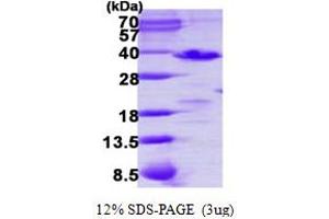 SDS-PAGE (SDS) image for Phosducin-Like 3 (PDCL3) (AA 1-239) protein (His tag) (ABIN668014)