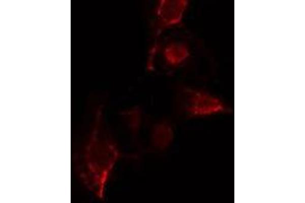 YOD1 antibody  (Internal Region)