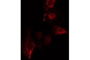 ABIN6275661 staining  COLO205 cells by IF/ICC.