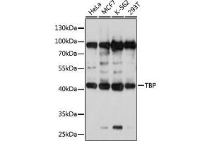 Western blot analysis of extracts of various cell lines, using TBP antibody (ABIN3023174, ABIN3023175, ABIN3023176 and ABIN1513589) at 1:1000 dilution. (TBP antibody  (AA 1-100))