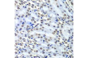 Immunohistochemistry of paraffin-embedded mouse kidney using Septin 7 antibody (ABIN1682655, ABIN3018092, ABIN3018093 and ABIN6220357) at dilution of 1:100 (40x lens). (7-Sep (AA 307-436) antibody)