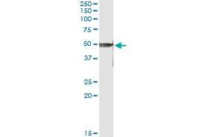 Immunoprecipitation of PRKX transfected lysate using anti-PRKX monoclonal antibody and Protein A Magnetic Bead , and immunoblotted with PRKX MaxPab rabbit polyclonal antibody. (PRKX antibody  (AA 269-358))