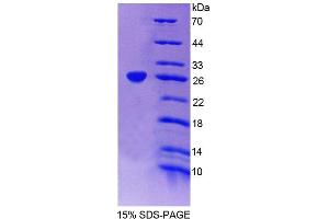 SDS-PAGE (SDS) image for Glutamyl-Prolyl-tRNA Synthetase (EPRS) (AA 749-956) protein (His tag) (ABIN4989682)