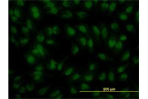 Immunofluorescence of monoclonal antibody to IRF2 on HeLa cell. (IRF2 antibody  (AA 216-315))