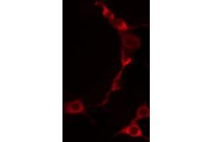 ABIN6274255 staining HuvEc by IF/ICC. (TNFSF9 antibody  (Internal Region))