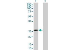 Lane 1: AK3 transfected lysate ( 25. (AK3 293T Cell Transient Overexpression Lysate(Denatured))