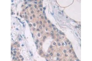 Figure. (CTAG1B antibody  (AA 1-180))