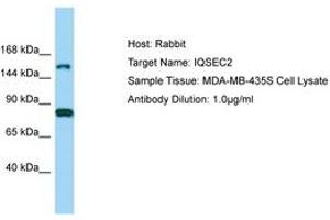 Image no. 1 for anti-IQ Motif and Sec7 Domain 2 (IQSEC2) (AA 351-400) antibody (ABIN6750202) (IQSEC2 antibody  (AA 351-400))