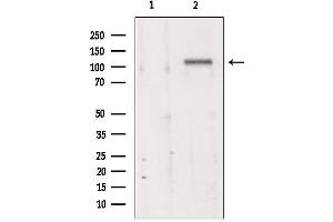Western blot analysis of extracts from 293, using MKS3 antibody. (TMEM67 antibody  (Internal Region))