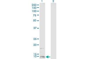 Western Blot analysis of CD59 expression in transfected 293T cell line by CD59 MaxPab polyclonal antibody. (CD59 antibody  (AA 1-128))