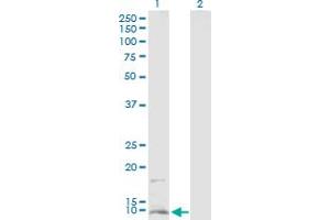 Western Blot analysis of CD59 expression in transfected 293T cell line by CD59 MaxPab polyclonal antibody. (CD59 antibody  (AA 1-128))