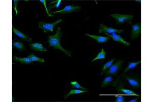 Immunofluorescence of purified MaxPab antibody to TRIT1 on HeLa cell. (TRIT1 antibody  (AA 1-467))