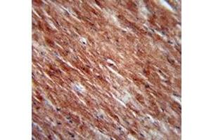 IL-2 antibody immunohistochemistry analysis in formalin fixed and paraffin embedded mouse heart tissue. (IL-2 antibody  (AA 50-77))