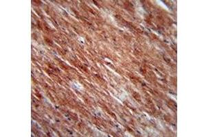 IL-2 antibody immunohistochemistry analysis in formalin fixed and paraffin embedded mouse heart tissue.
